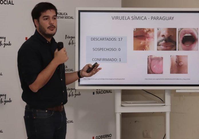 Viruela del mono